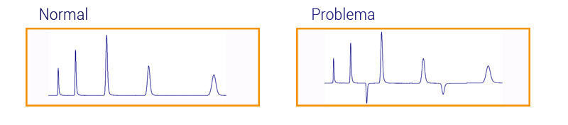 Picos negativos HPLC